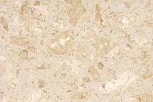 法国金花(岗石)